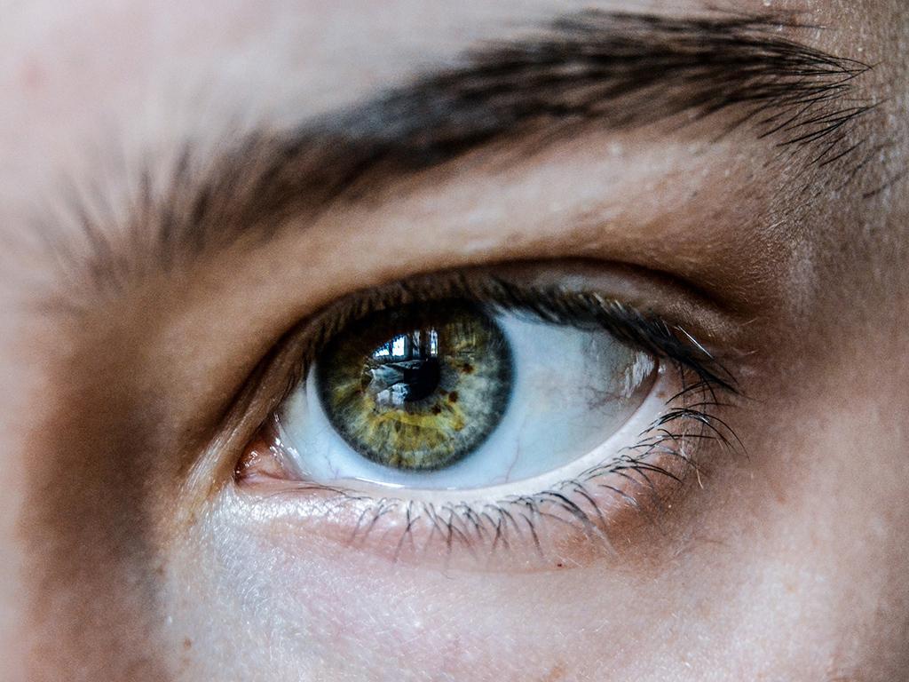 Is conjunctivitis commonly known as pink eye?